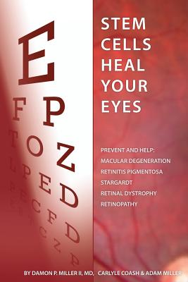 Stem Cells Heal Your Eyes: Prevent and Help: Macular Degeneration, Retinitis Pigmentosa, Stargardt, Retinal Distrophy, and Retinopathy. by Miller II MD, Damon P./ Coash Ma, Carlyle/ Miller, Adam [Paperback]